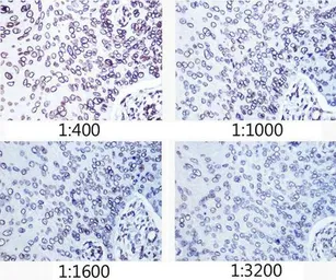 Anti-Lamin A + C antibody [GT1137] used in IHC (Paraffin sections) (IHC-P). GTX00774