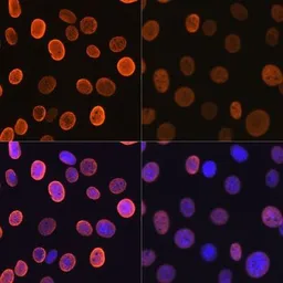 Anti-Histone H4K5ac (acetyl Lys5) antibody [GT1138] used in Immunocytochemistry/ Immunofluorescence (ICC/IF). GTX00775