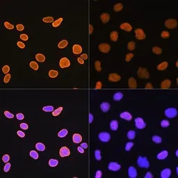 Anti-Histone H4K5ac (acetyl Lys5) antibody [GT1138] used in Immunocytochemistry/ Immunofluorescence (ICC/IF). GTX00775
