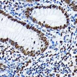 Anti-Histone H4K5ac (acetyl Lys5) antibody [GT1138] used in IHC (Paraffin sections) (IHC-P). GTX00775