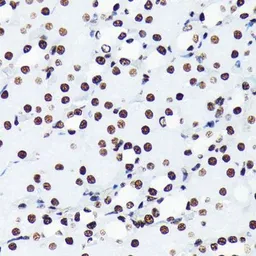 Anti-Histone H4K5ac (acetyl Lys5) antibody [GT1138] used in IHC (Paraffin sections) (IHC-P). GTX00775