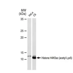 Anti-Histone H4K5ac (acetyl Lys5) antibody [GT1138] used in Western Blot (WB). GTX00775