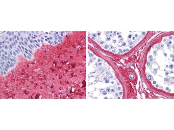 Anti-Collagen III antibody (HRP) used in IHC (Paraffin sections) (IHC-P). GTX00777