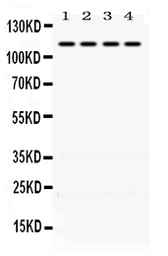 Anti-Mineralocorticoid Receptor antibody used in Western Blot (WB). GTX00779