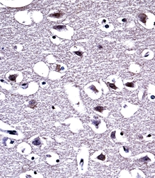 Anti-Mu Opioid receptor antibody used in IHC (Paraffin sections) (IHC-P). GTX00782