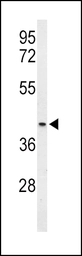 Anti-Mu Opioid receptor antibody used in Western Blot (WB). GTX00782