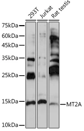 Anti-MT2A antibody used in Western Blot (WB). GTX00789