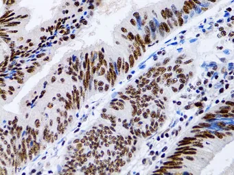 Anti-MT2A antibody used in IHC (Paraffin sections) (IHC-P). GTX00789