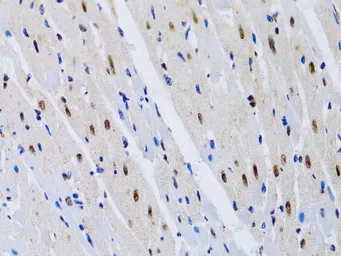 Anti-MT2A antibody used in IHC (Paraffin sections) (IHC-P). GTX00789