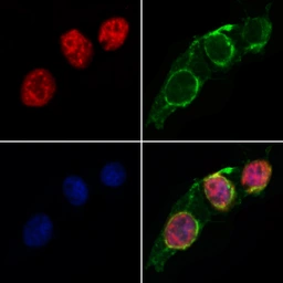 Anti-RUNX2 antibody used in Immunocytochemistry/ Immunofluorescence (ICC/IF). GTX00792