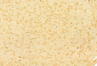 Anti-RUNX2 antibody used in IHC (Paraffin sections) (IHC-P). GTX00792