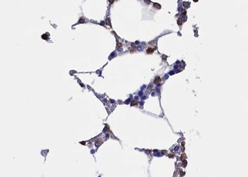 Anti-RUNX2 antibody used in IHC (Paraffin sections) (IHC-P). GTX00792