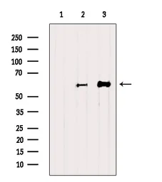 Anti-RUNX2 antibody used in Western Blot (WB). GTX00792
