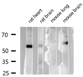 Anti-RUNX2 antibody used in Western Blot (WB). GTX00792