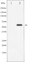 Anti-RUNX2 antibody used in Western Blot (WB). GTX00792