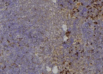 Anti-TIE2 (phospho Tyr992) antibody used in IHC (Paraffin sections) (IHC-P). GTX00794