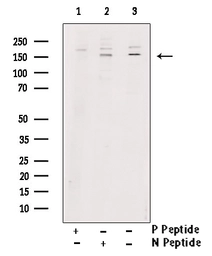 Anti-TIE2 (phospho Tyr992) antibody used in Western Blot (WB). GTX00794