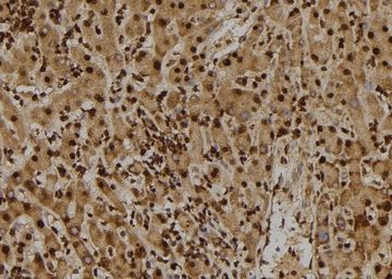 Anti-TIE2 (phospho Tyr897) antibody used in IHC (Paraffin sections) (IHC-P). GTX00795