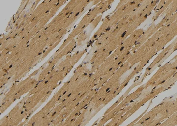 Anti-TIE2 (phospho Tyr897) antibody used in IHC (Paraffin sections) (IHC-P). GTX00795