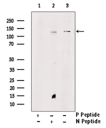 Anti-TIE2 (phospho Tyr897) antibody used in Western Blot (WB). GTX00795