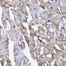 Anti-Prohibitin antibody [GT1139] used in IHC (Paraffin sections) (IHC-P). GTX00797