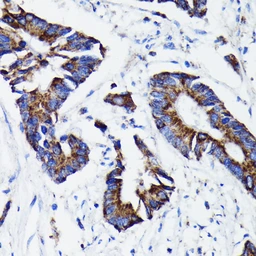 Anti-Prohibitin antibody [GT1139] used in IHC (Paraffin sections) (IHC-P). GTX00797
