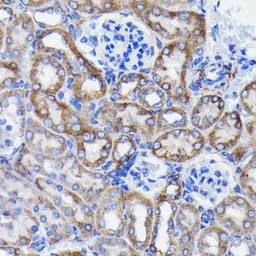 Anti-Prohibitin antibody [GT1139] used in IHC (Paraffin sections) (IHC-P). GTX00797
