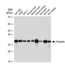 Anti-Prohibitin antibody [GT1139] used in Western Blot (WB). GTX00797