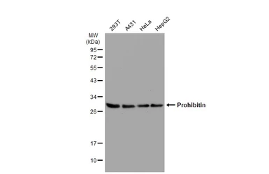 Anti-Prohibitin antibody [GT1139] used in Western Blot (WB). GTX00797