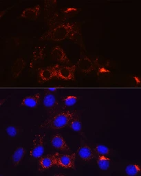 Anti-PDGF Receptor beta antibody [GT1140] used in Immunocytochemistry/ Immunofluorescence (ICC/IF). GTX00798