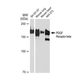 Anti-PDGF Receptor beta antibody [GT1140] used in Western Blot (WB). GTX00798