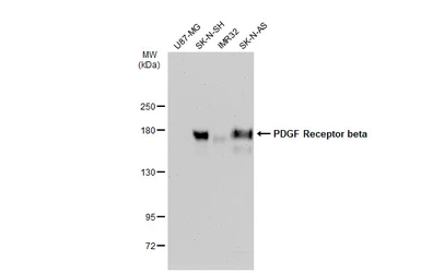 Anti-PDGF Receptor beta antibody [GT1140] used in Western Blot (WB). GTX00798