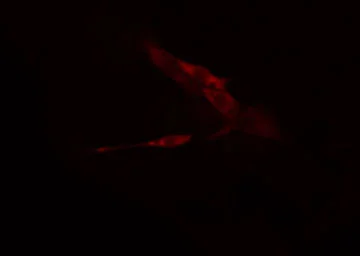 Anti-MARK4 antibody used in Immunocytochemistry/ Immunofluorescence (ICC/IF). GTX00800