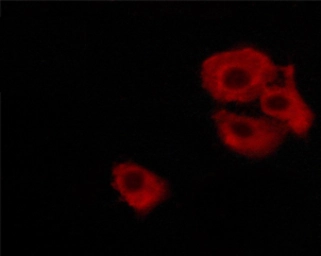 Anti-DARPP-32 (phospho Thr34) antibody used in Immunocytochemistry/ Immunofluorescence (ICC/IF). GTX00802