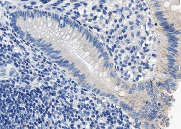 Anti-DARPP-32 (phospho Thr34) antibody used in IHC (Paraffin sections) (IHC-P). GTX00802