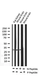 Anti-DARPP-32 (phospho Thr34) antibody used in Western Blot (WB). GTX00802