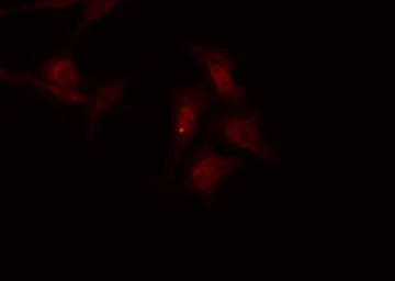 Anti-DARPP-32 (phospho Thr75) antibody used in Immunocytochemistry/ Immunofluorescence (ICC/IF). GTX00803