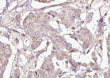 Anti-DARPP-32 (phospho Thr75) antibody used in IHC (Paraffin sections) (IHC-P). GTX00803