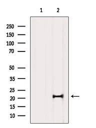 Anti-MED29 antibody used in Western Blot (WB). GTX00806