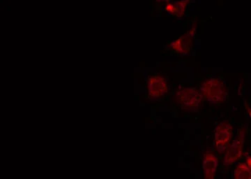 Anti-CLCN7 antibody used in Immunocytochemistry/ Immunofluorescence (ICC/IF). GTX00807