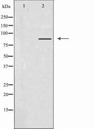Anti-CLCN7 antibody used in Western Blot (WB). GTX00807