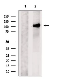 Anti-PACS2 antibody used in Western Blot (WB). GTX00808