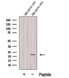Anti-DDIT4L antibody used in Western Blot (WB). GTX00809