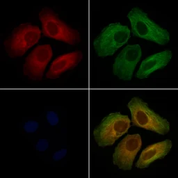 Anti-OSBPL2 antibody used in Immunocytochemistry/ Immunofluorescence (ICC/IF). GTX00814