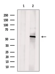 Anti-OSBPL2 antibody used in Western Blot (WB). GTX00814