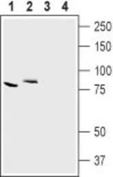 Anti-CLCN7 antibody used in Western Blot (WB). GTX00817