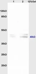 Anti-Pentraxin 3 antibody used in Western Blot (WB). GTX00819