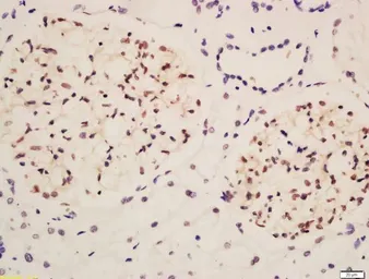 Anti-NPHS2 antibody used in IHC (Paraffin sections) (IHC-P). GTX00821