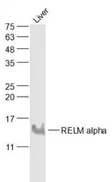 Anti-RELM alpha antibody used in Western Blot (WB). GTX00822