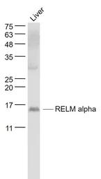 Anti-RELM alpha antibody used in Western Blot (WB). GTX00822